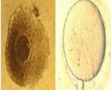 未成熟卵体体外成熟技术